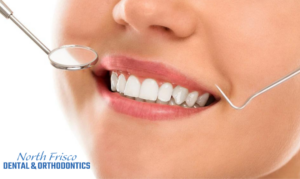 Advantages Of Dental Bonding