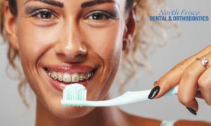 Impact of Fluoride in Orthodontics Treatment