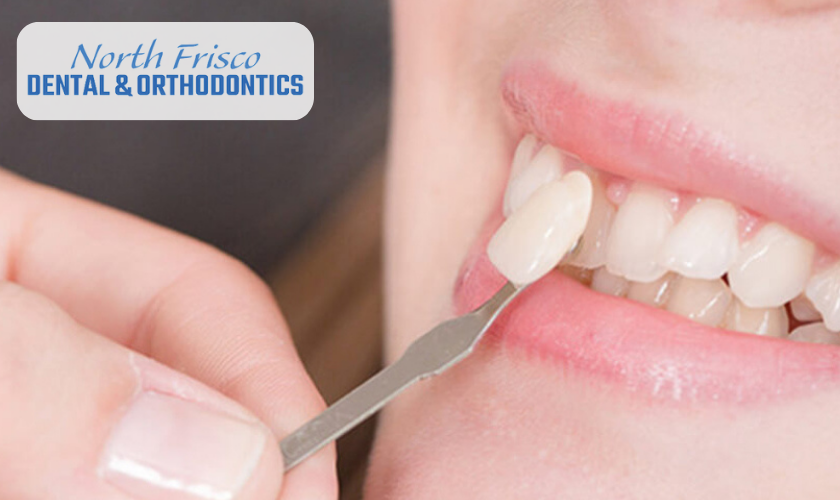 What should I do to take care of new dental veneers