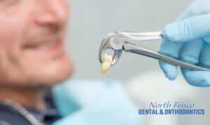 Get Your Wisdom Teeth Removed