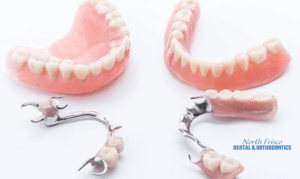 A Guide To Choosing Dentures