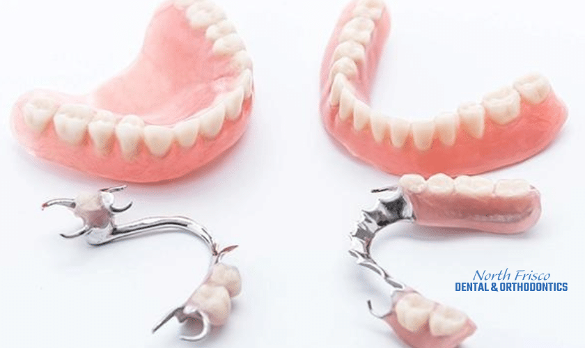 A Guide To Choosing Dentures