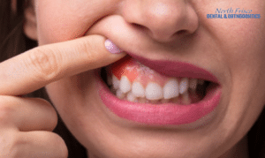 Periodontal Diseases: Risk Factors And Preventive Measures