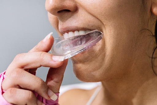 img-Athletic-Mouth-Guards