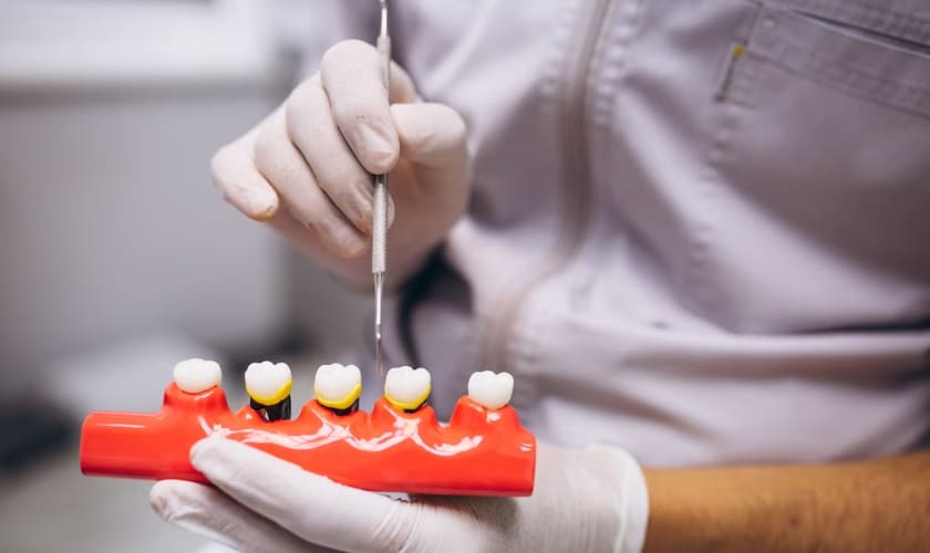 Dental Crowns in Frisco, TX, North Frisco Dental & Orthodontics