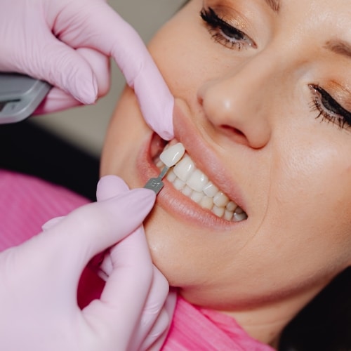 Dental Veneers in Frisco, TX, North Frisco Dental & Orthodontics
