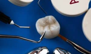 Dental Composite Technology