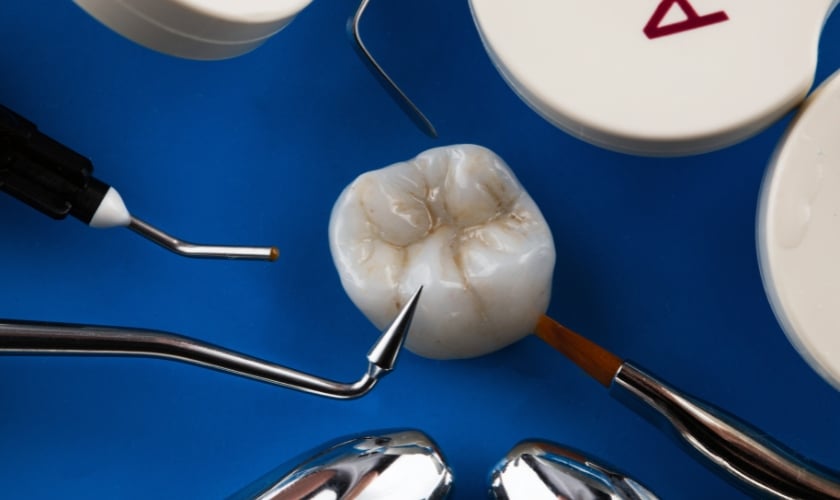 Dental Composite Technology