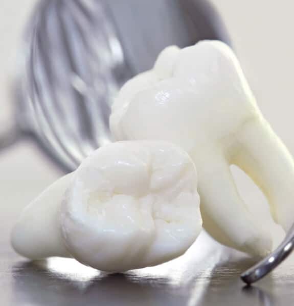 Tooth Extraction in Frisco