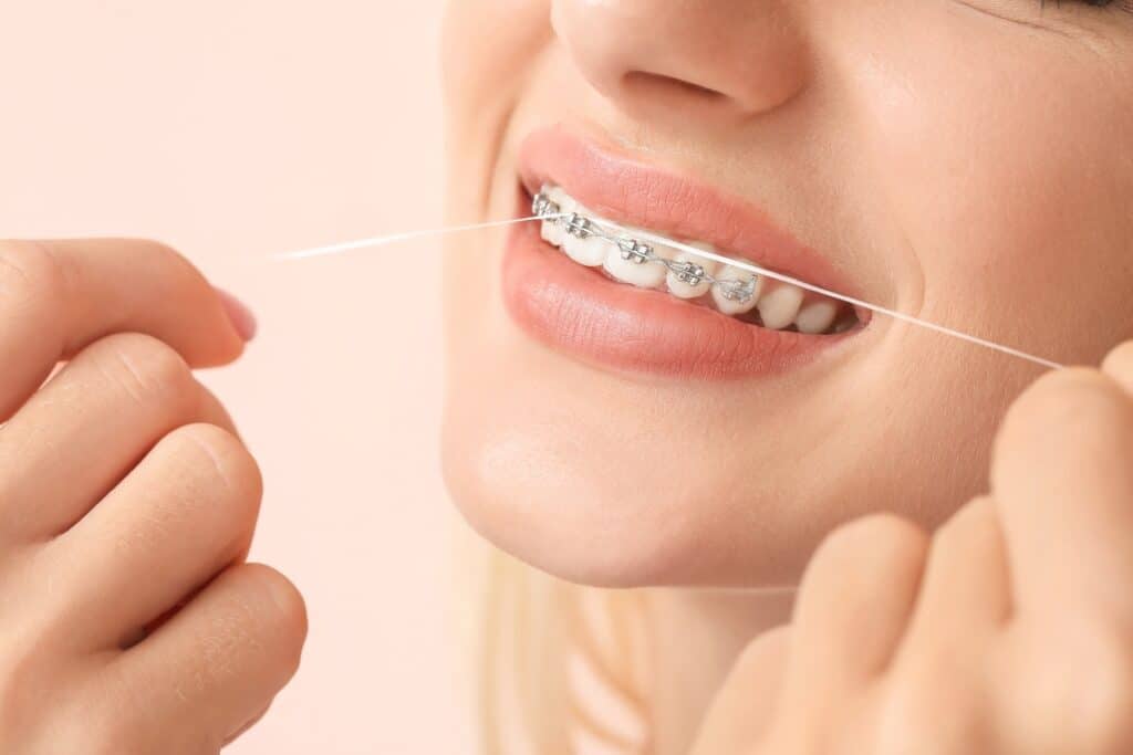 tricks to make flossing with braces easier