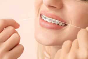 tricks to make flossing with braces easier