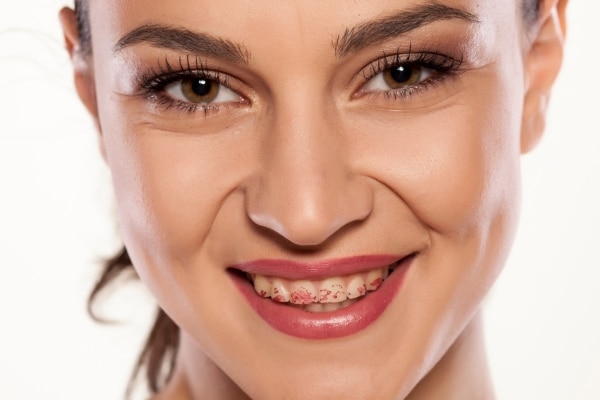 don’t let halloween candy damage your teeth