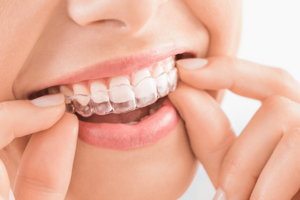 Is Invisalign Painful? What To Expect During Treatment