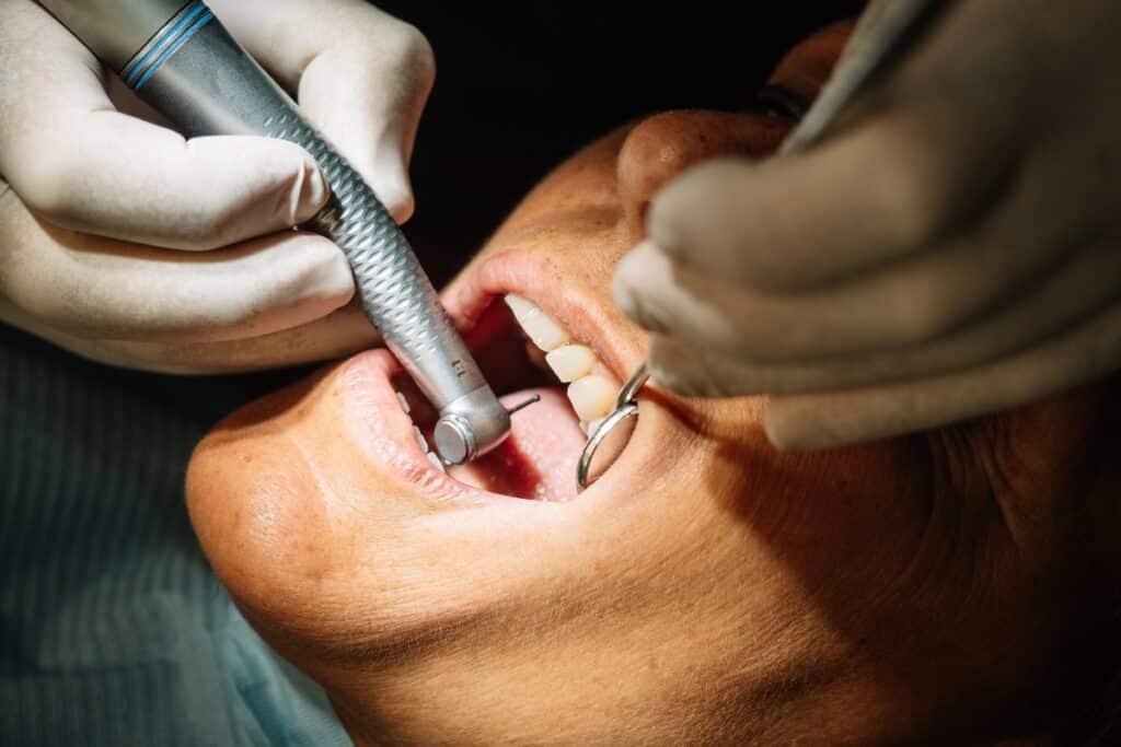 dental-implants-frisco