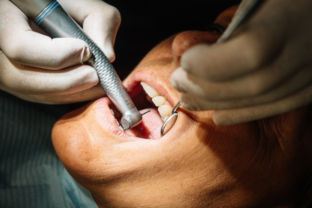 dental-implants-frisco