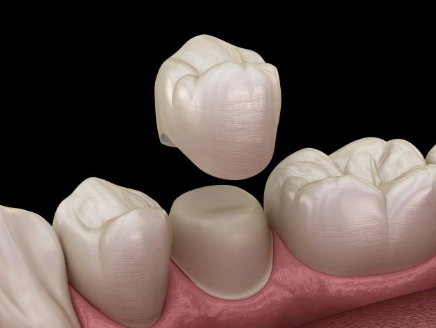 Painless Tooth Extractions for a Better Oral Health
