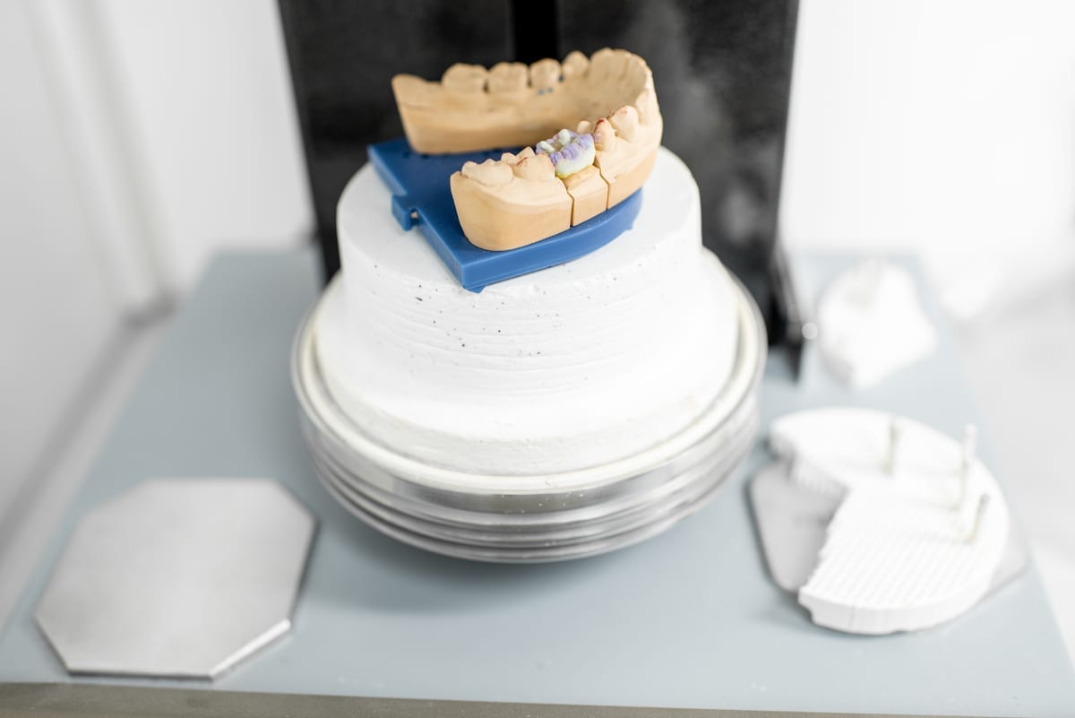 Dental Crowns in Frisco
